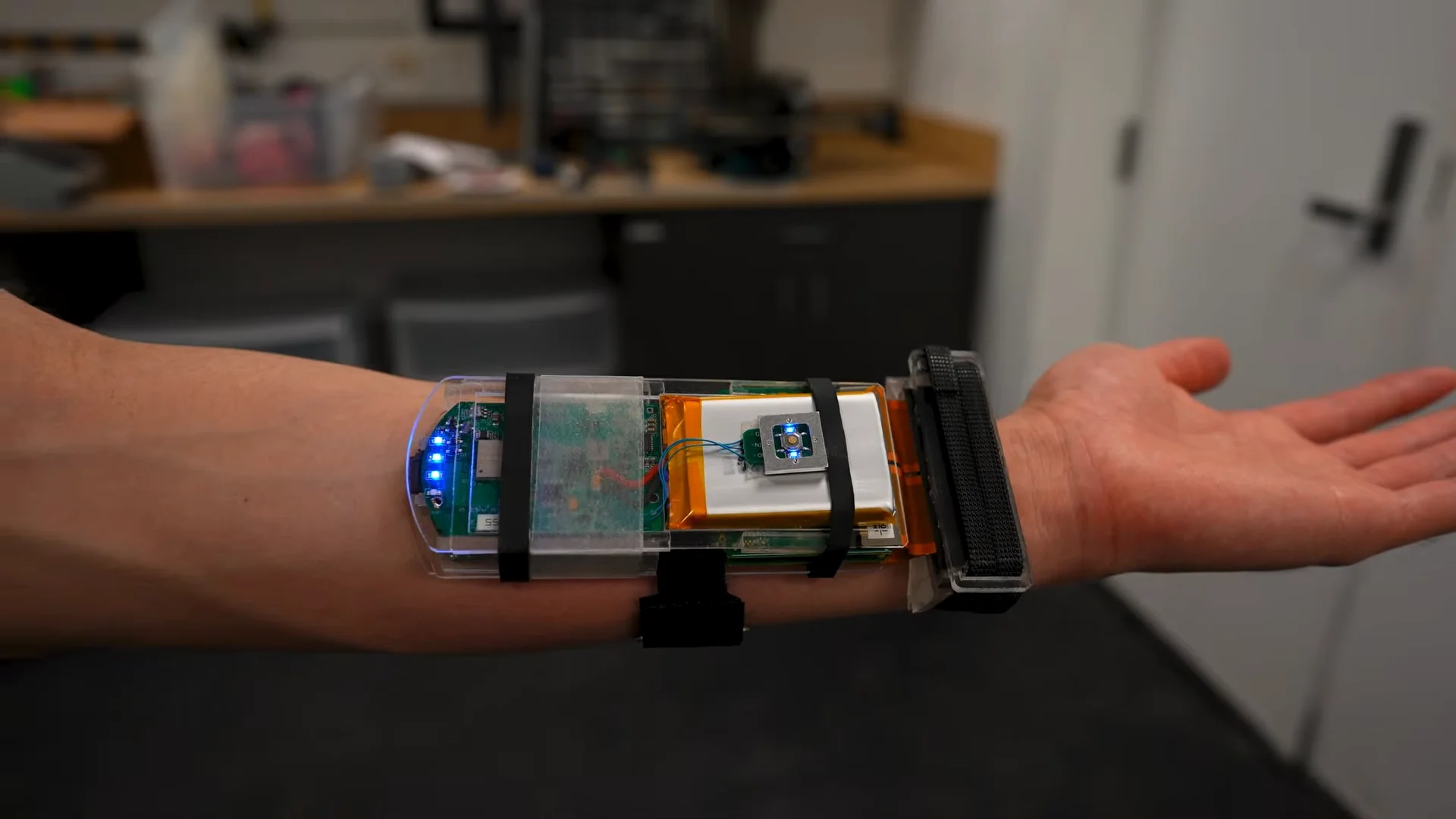 A close-up view of the prototype MIT ultrasound wristband strapped to a forearm, featuring a transparent casing that reveals circuit boards, a battery, and glowing blue LED lights.